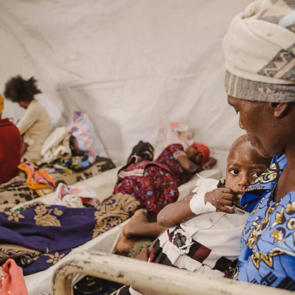 Mpox infection poses serious threat to health of children and pregnant women in endemic countries